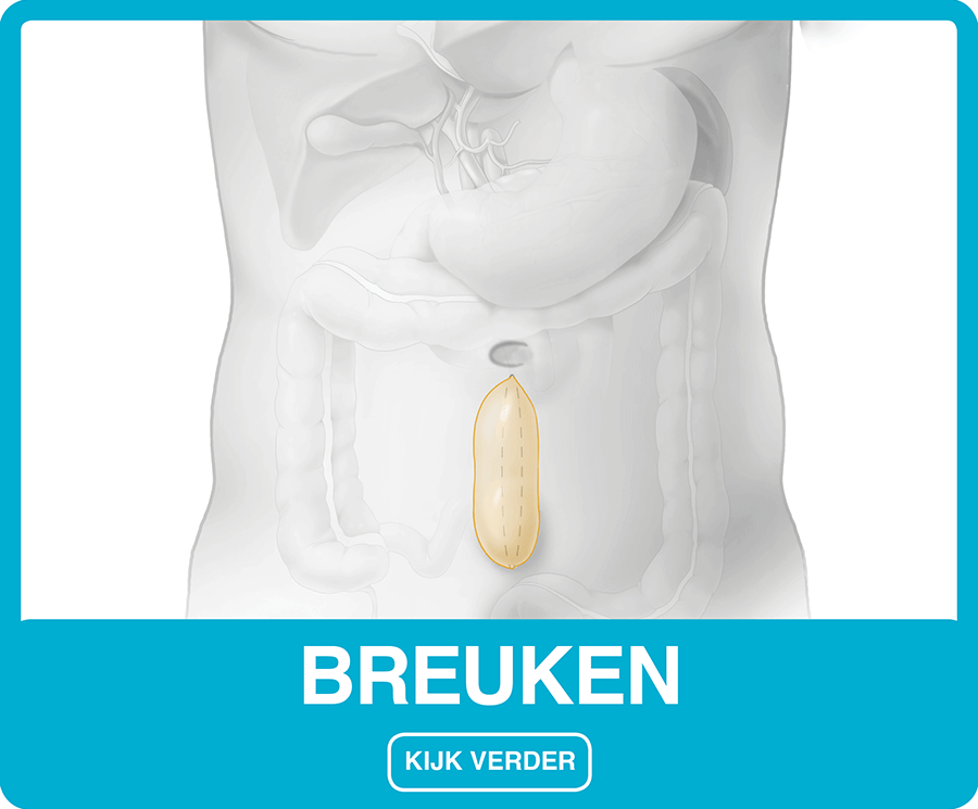 Breuken