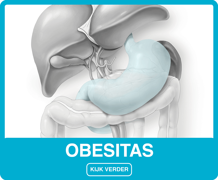 Obesitas