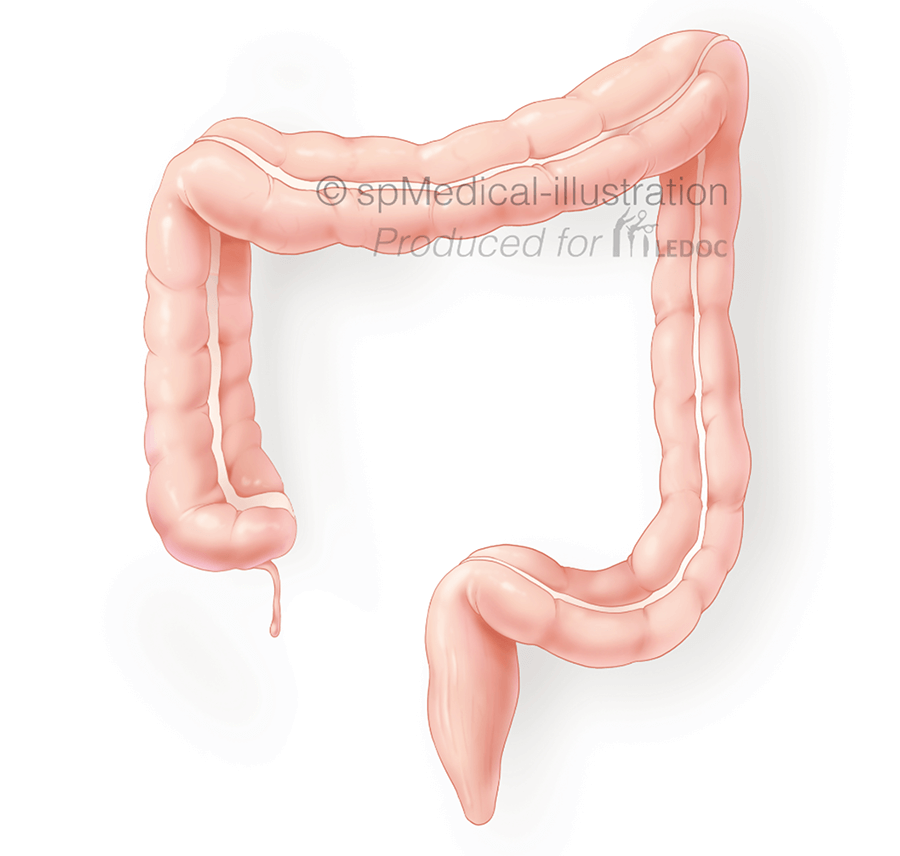 Colon overzicht