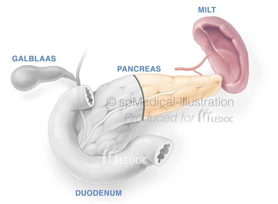 Pancreasstaart