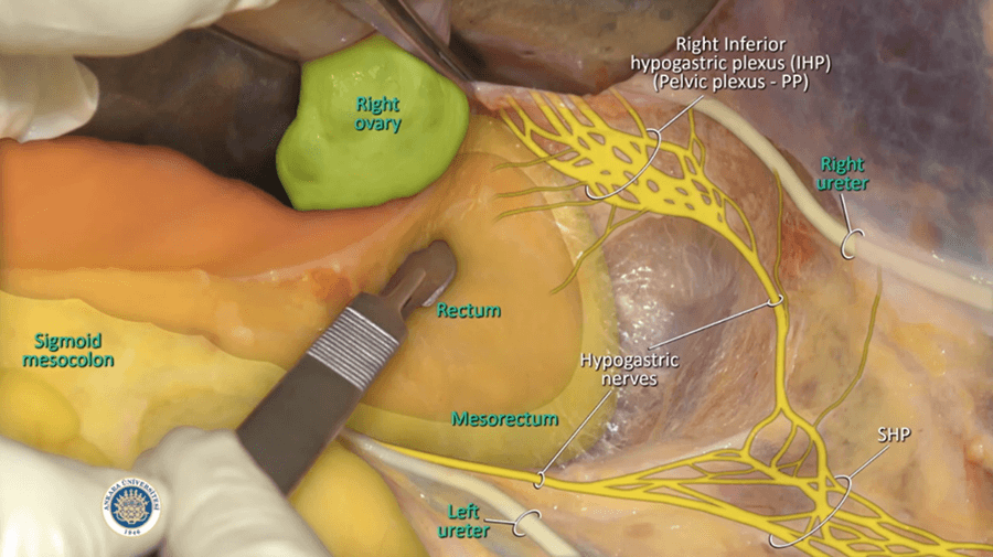 Zenuwen bij rectum chirurgie