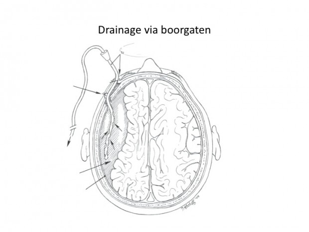 Drainage via boorgaten