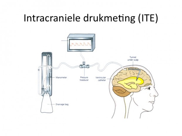 Intracraniële drukmeting